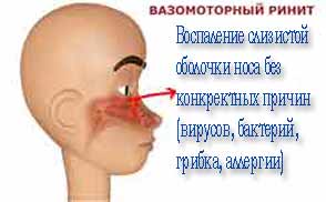 У 3 месячного ребенка насморк чем лечить